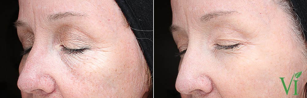 Anti Aging 7 Anti Aging 7