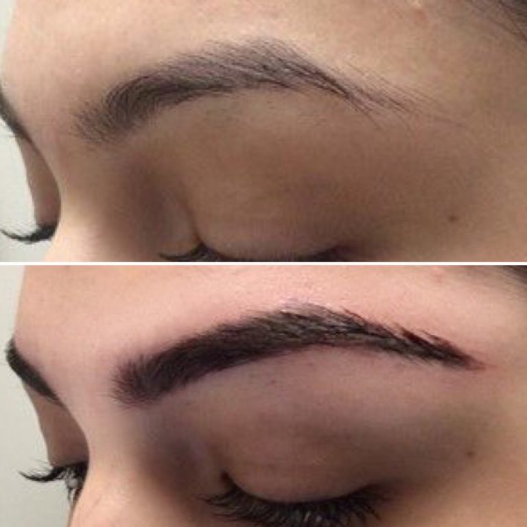 brows1 768x768 1