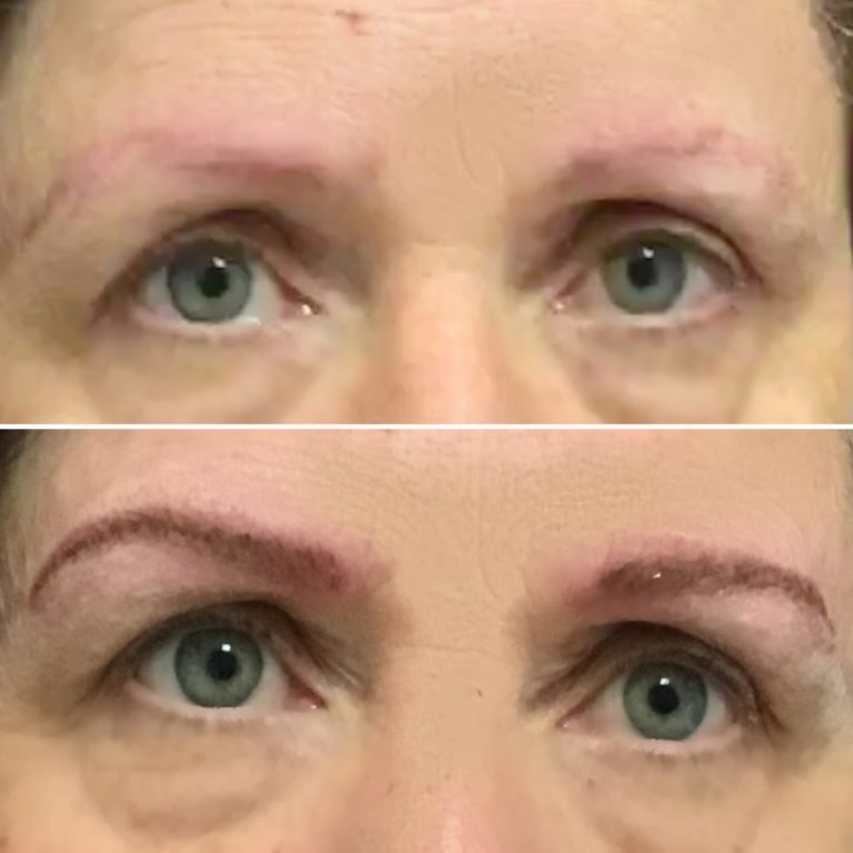 brows2 768x768 1
